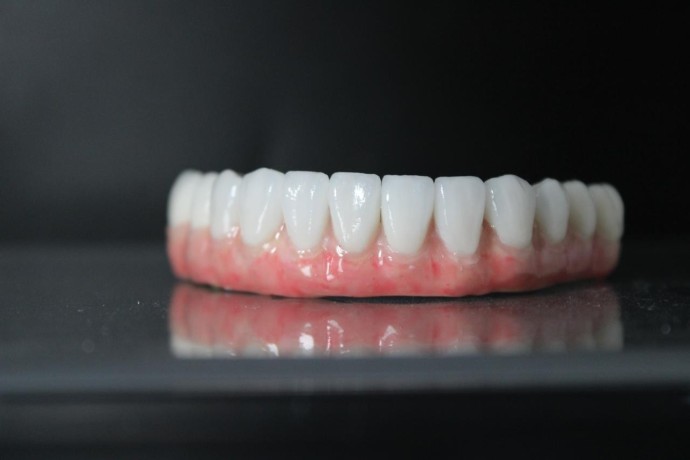 full-mouth-dental-implants-in-mexico-with-teeth-savers-big-0