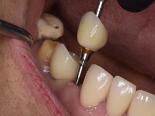 Transform your smile and appeal with steadfast Cosmetic dentist in Tijuana