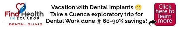 do-you-need-dental-work-how-about-a-vacation-you-can-have-both-now-big-0