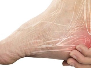 Plantar Fasciitis Specialist